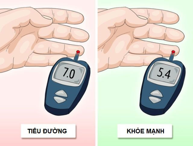 Kiểm soát đường huyết