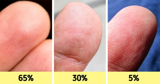 12 Đặc Điểm Cơ Thể Hiếm Gặp Chỉ Một Số Người Sở Hữu